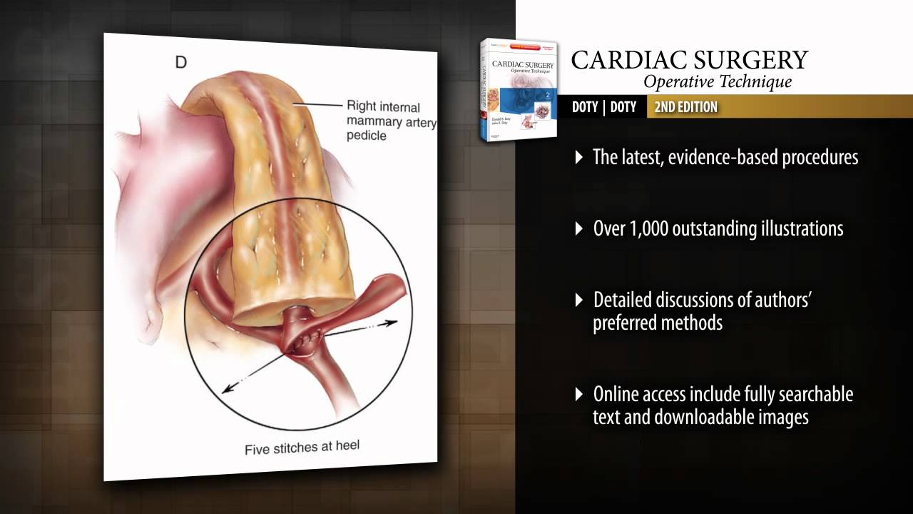 Cardiac Surgery, 2nd Edition