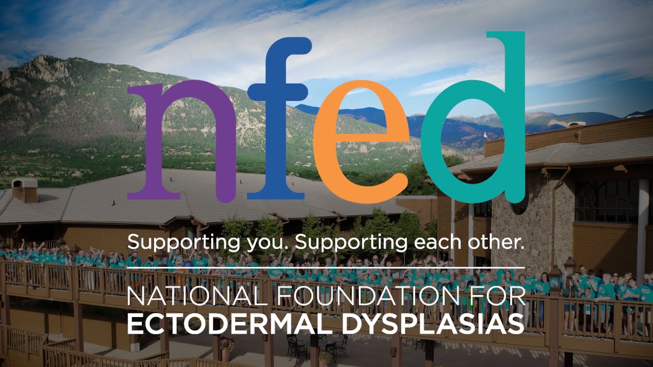 Welcome to the NFED! Learn About Ectodermal Dysplasia