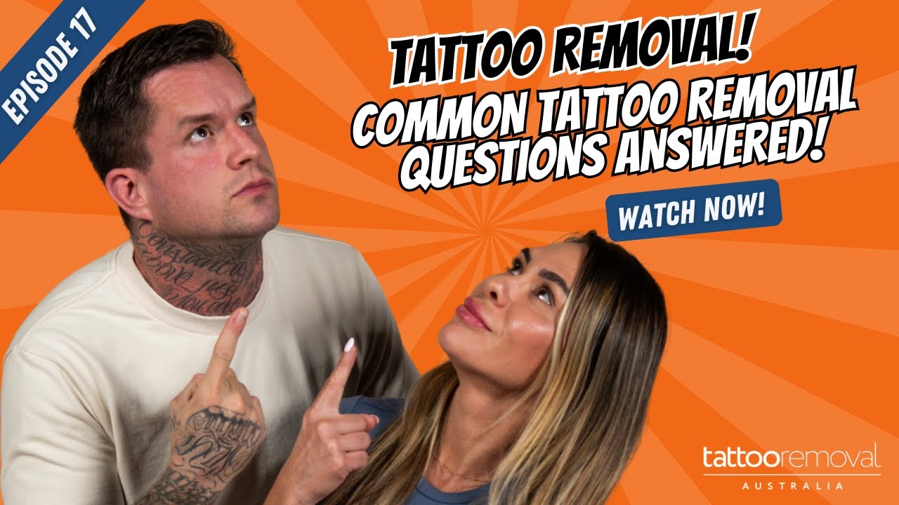 Tattoo Removal: The Most Common Questions Answered (EVERYTHING you need to know)