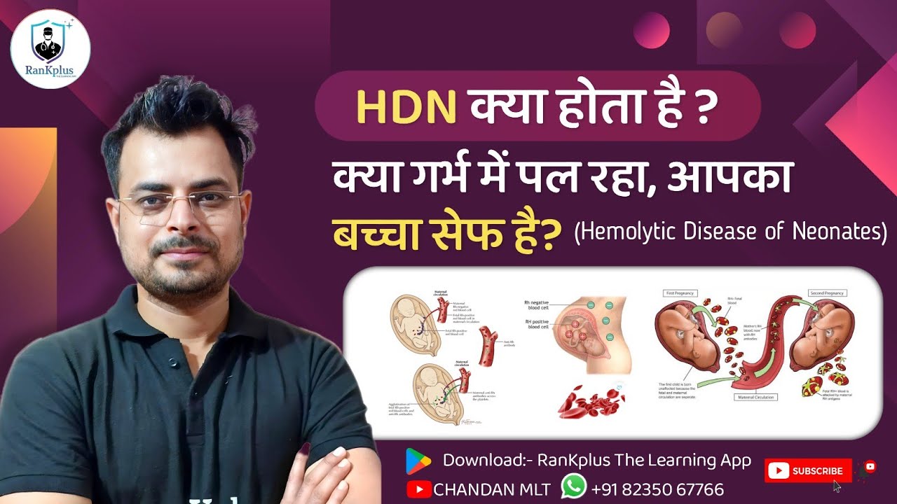 Hemolytic Disease Of The Newborn (HDN) | Erythroblastosis Fetalis | Hemolytic Disease of a Neonates