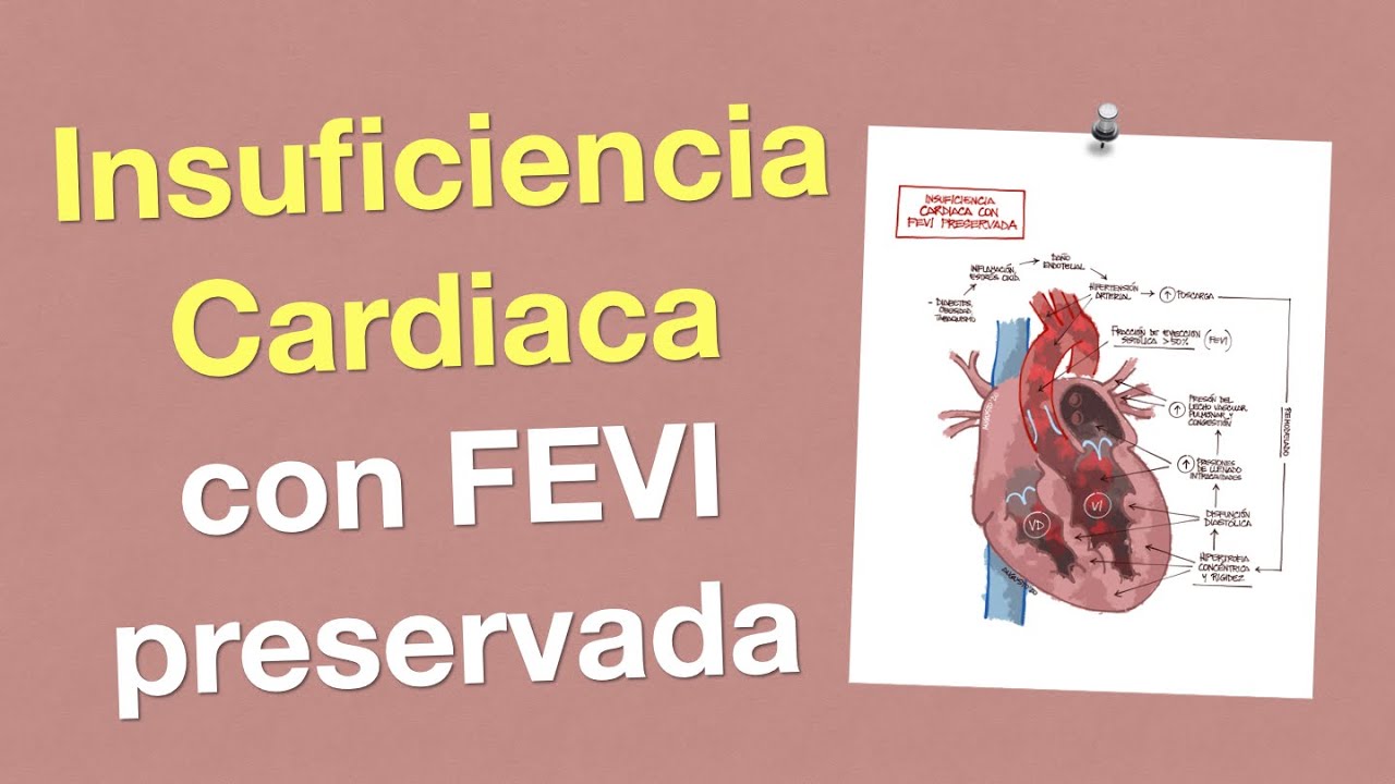 Insuficiencia cardiaca con FEVI preservada: Fisiopatología