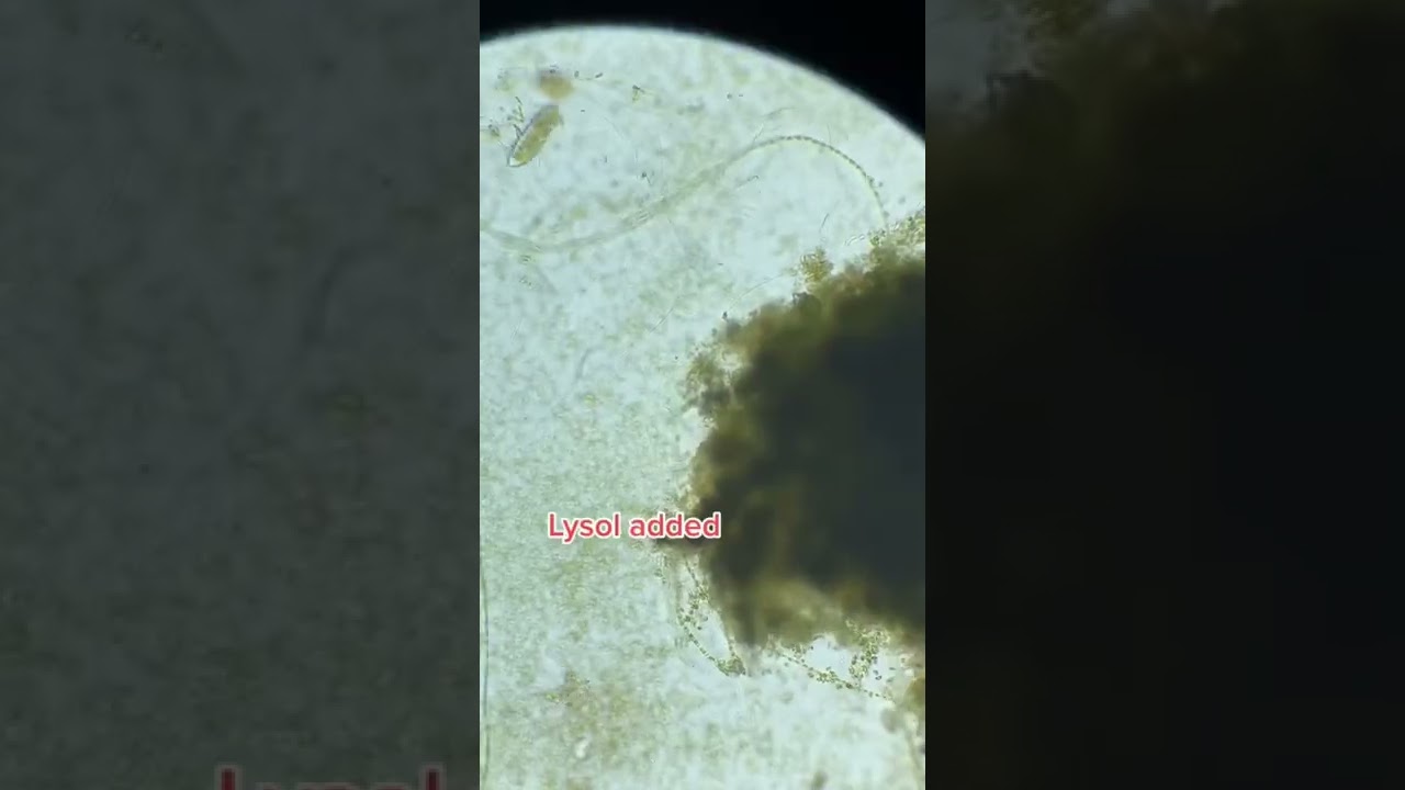 Cell Explodes Under Microscope (Lysol Added) 
