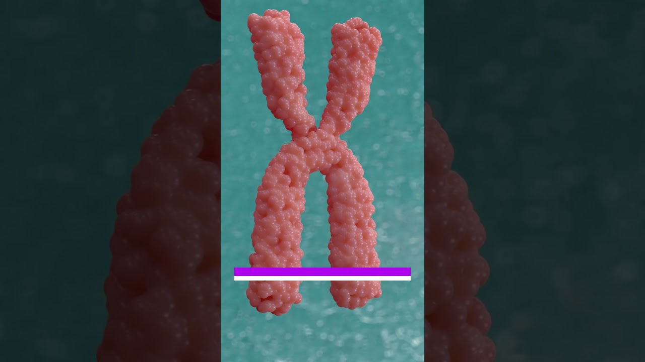 Genetik İşitme Kaybı Nasıl Gelişir? / How Does Genetic Hearing Loss Develop?  #işitmekaybı