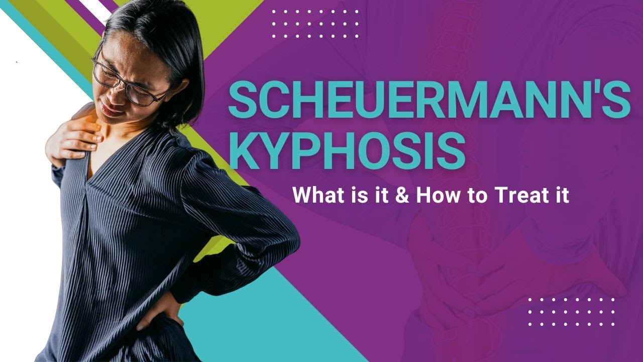 Scheuermann's Kyphosis - What is it & How to Treat it
