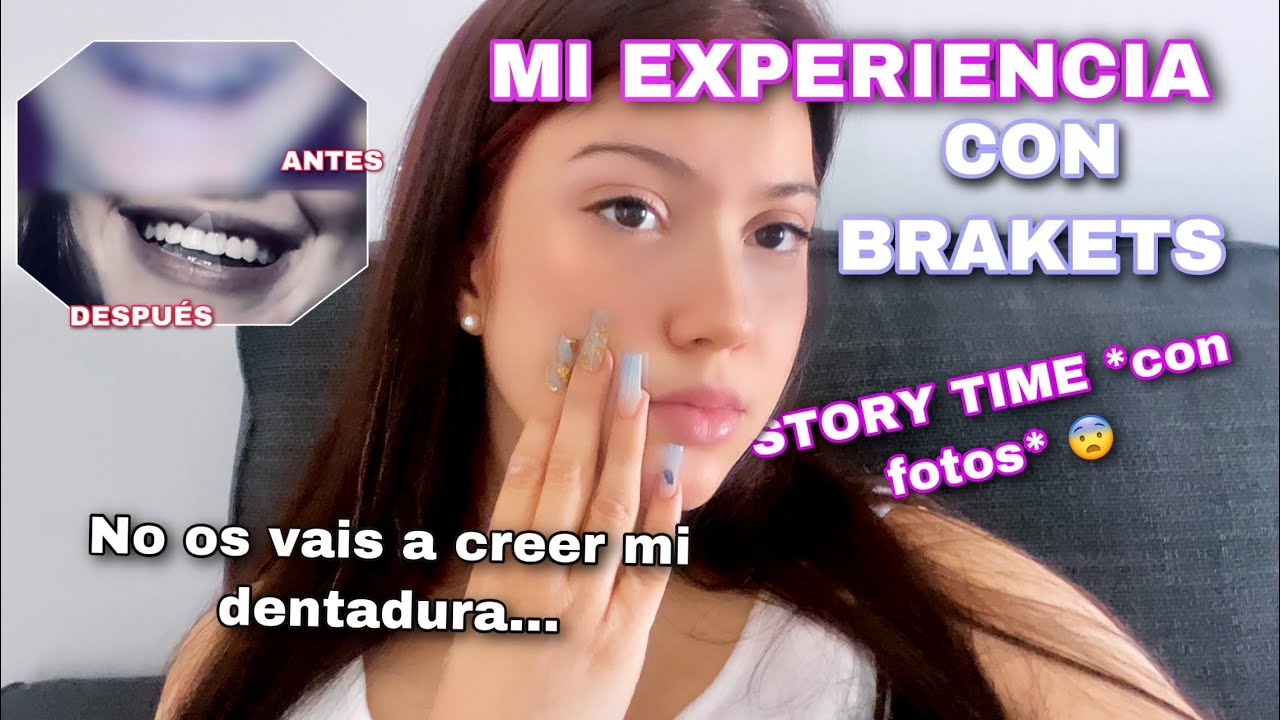 MI experiencia con La ORTODONCIA 🦷 ¿cuánto me costó? 💸 ANTES y DESPUÉS 😨 *con fotos*