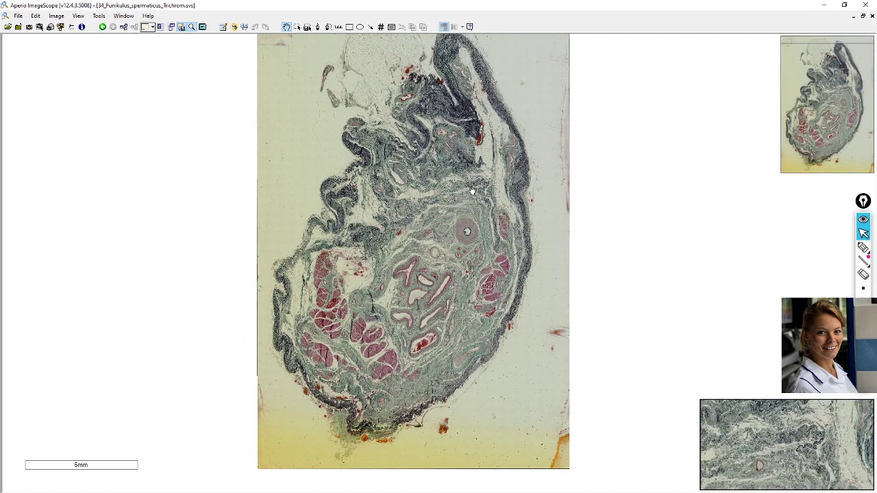ductus deferens (chámovod) - funiculus spermaticus (semenný provazec)