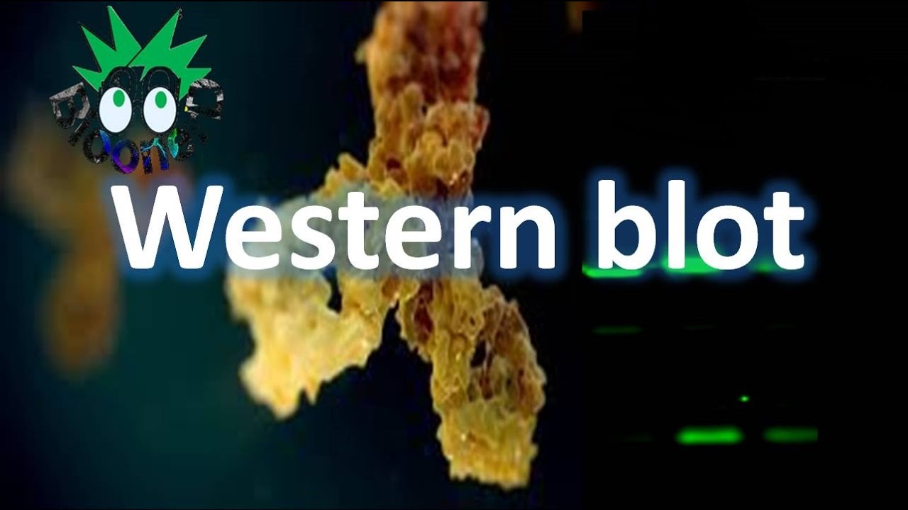 Western blot-Imuno blot