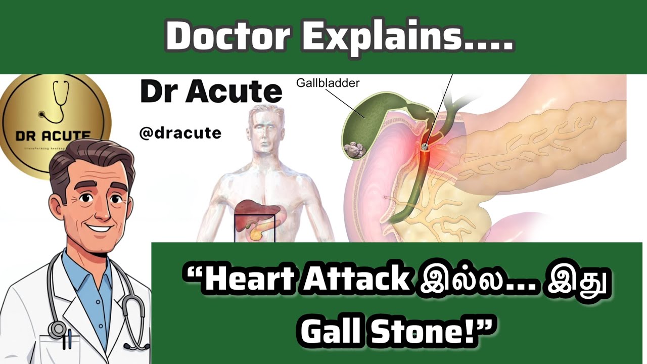 Gall Stone Disease in Tamil | Symptoms, Causes, Scan, Surgery Explained by Doctor ! Dr Acute