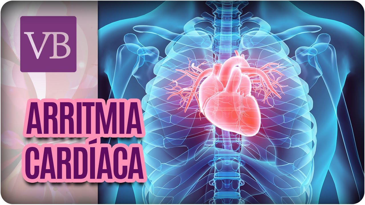 Arritmia Cardíaca - Você Bonita (29/06/17)