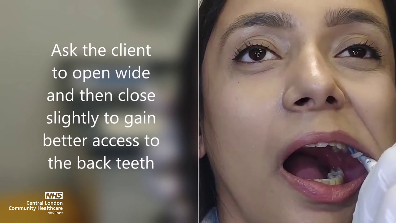 Supported Brushing