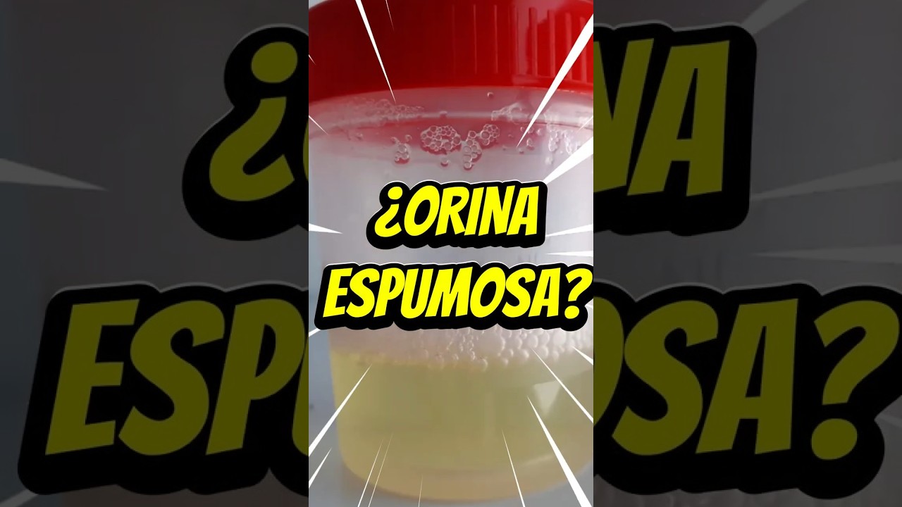 Orina espumosa: ¿normal o señal renal? 