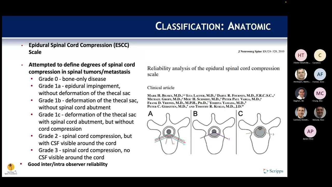 Metastatic Spine Disease Classification presented by Matthew Henriques, MD on January 16, 2023.