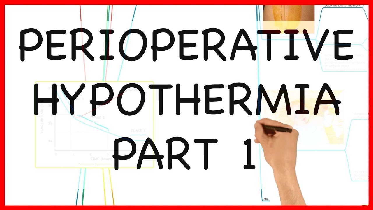 PERIOPERATIVE HYPOTHERMIA PART 1 -PHYSIOLOGY SERIES