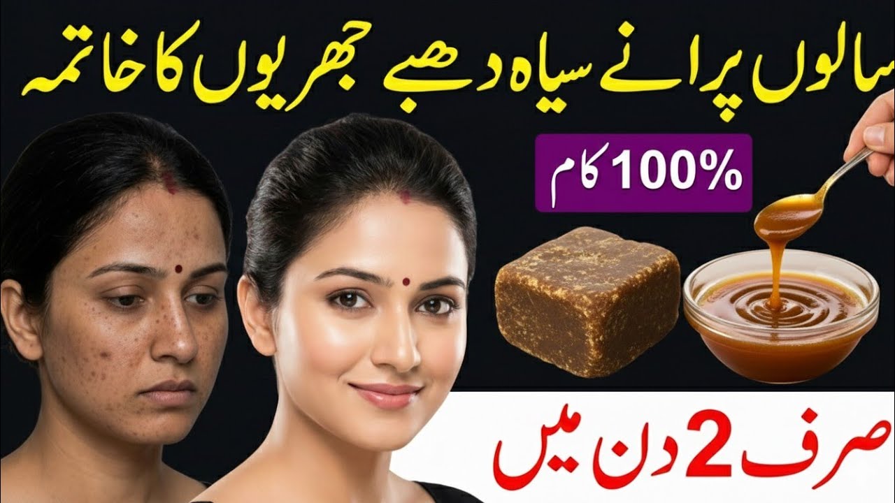 Homemade 0 Cost Skin Whitening Mask | Just one Time Apply all skin problems will be gone forever2026