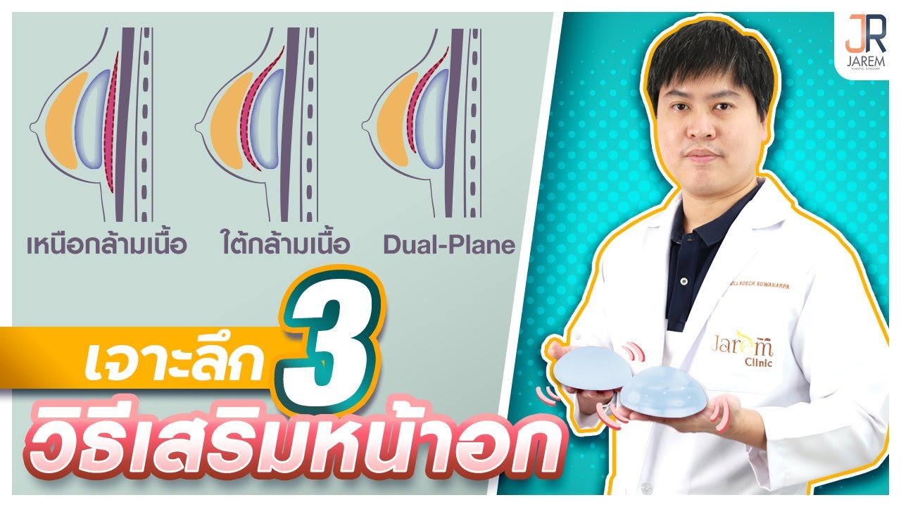 เสริมหน้าอก 😊ใต้กล้ามเนื้อ🔻เหนือกล้ามเนื้อ🔺Dual plane ⭕️ ต่างกันอย่างไร? | jarem clinic