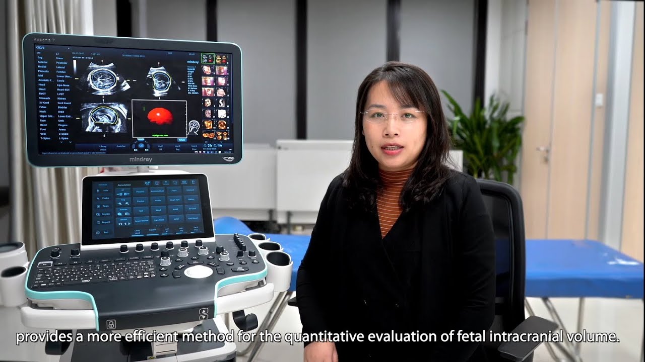 Mindray-Smart ICV Demonstration