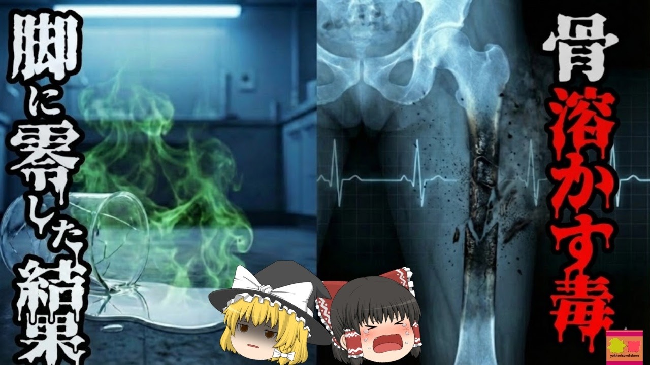 【1994】『硫酸より怖い液体』を足に零してしまった研究者の体内で一体何が起きていたのか？歴史の中で最も教訓的かつ恐ろしい『フッ化水素酸飛散事故』を解説