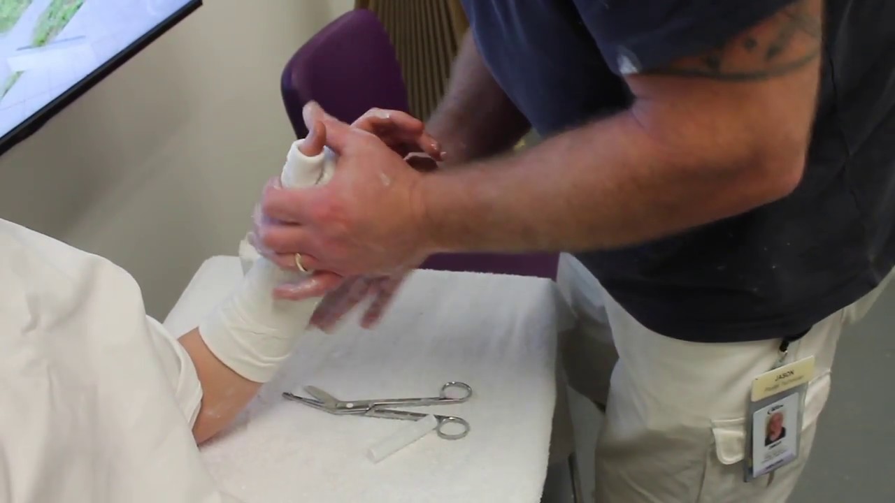 Full scaphoid cast