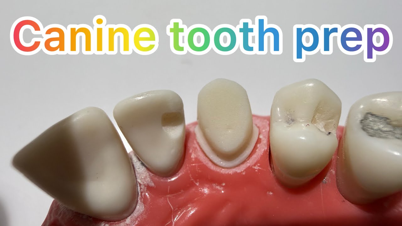 Master the art of Canine Tooth Crown Preparation | Dr.Dentique-hub