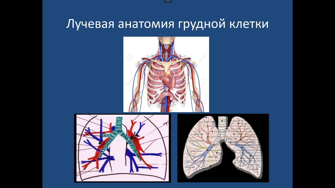 Грудная клетка. Радиологическая анатомия. Лекция 1.