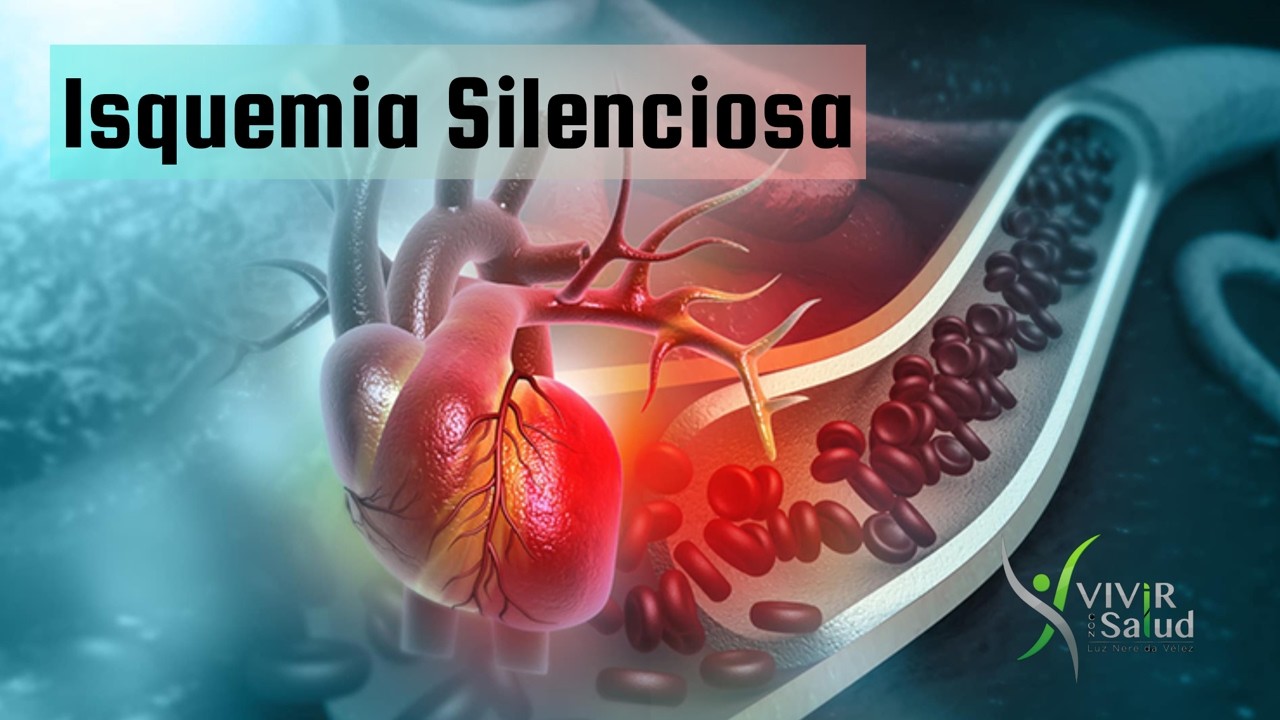 ISQUEMIA SILENCIOSA