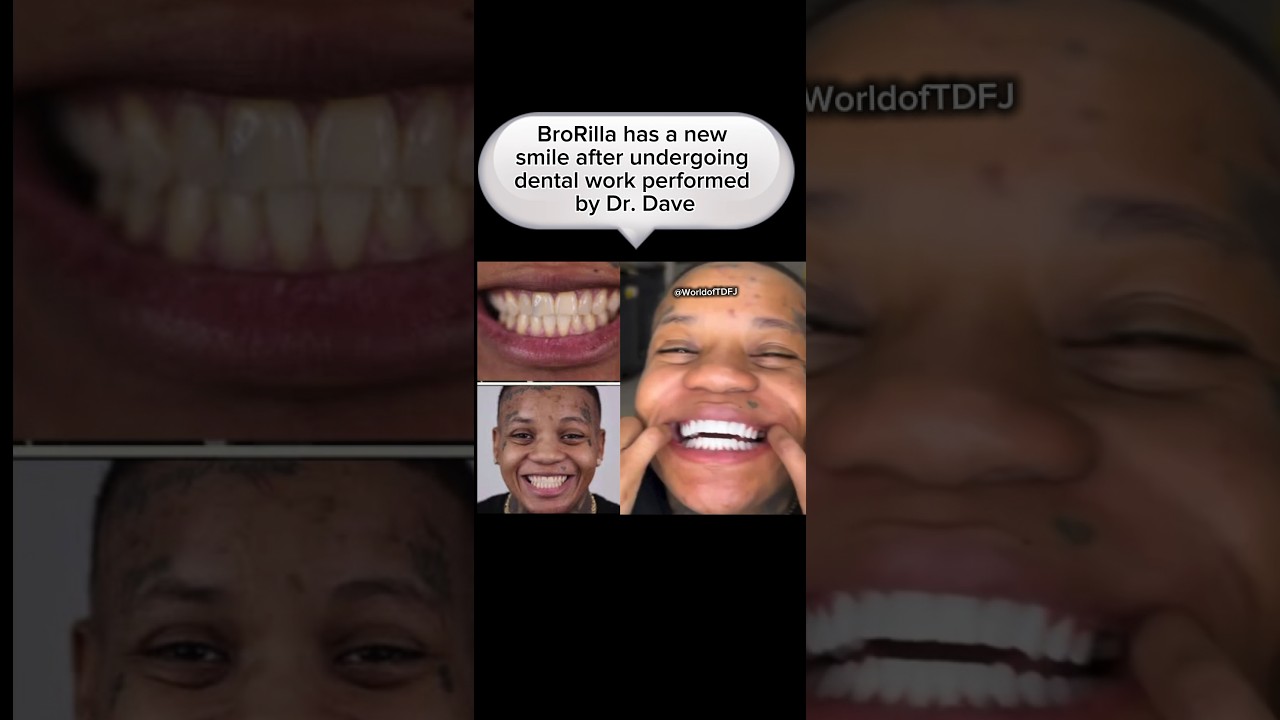Glorilla sister BroRilla has a new smile after undergoing dental work performed by Dr. Dave