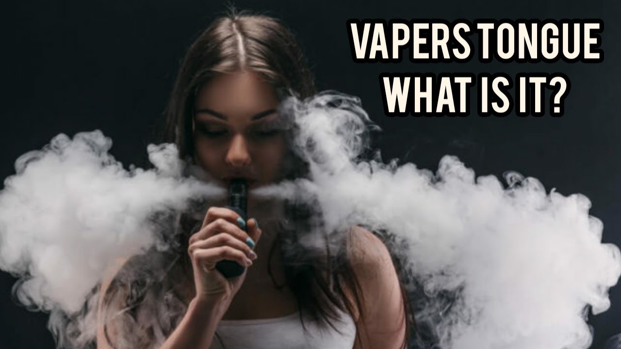 Vapers Tongue ... What is it?!