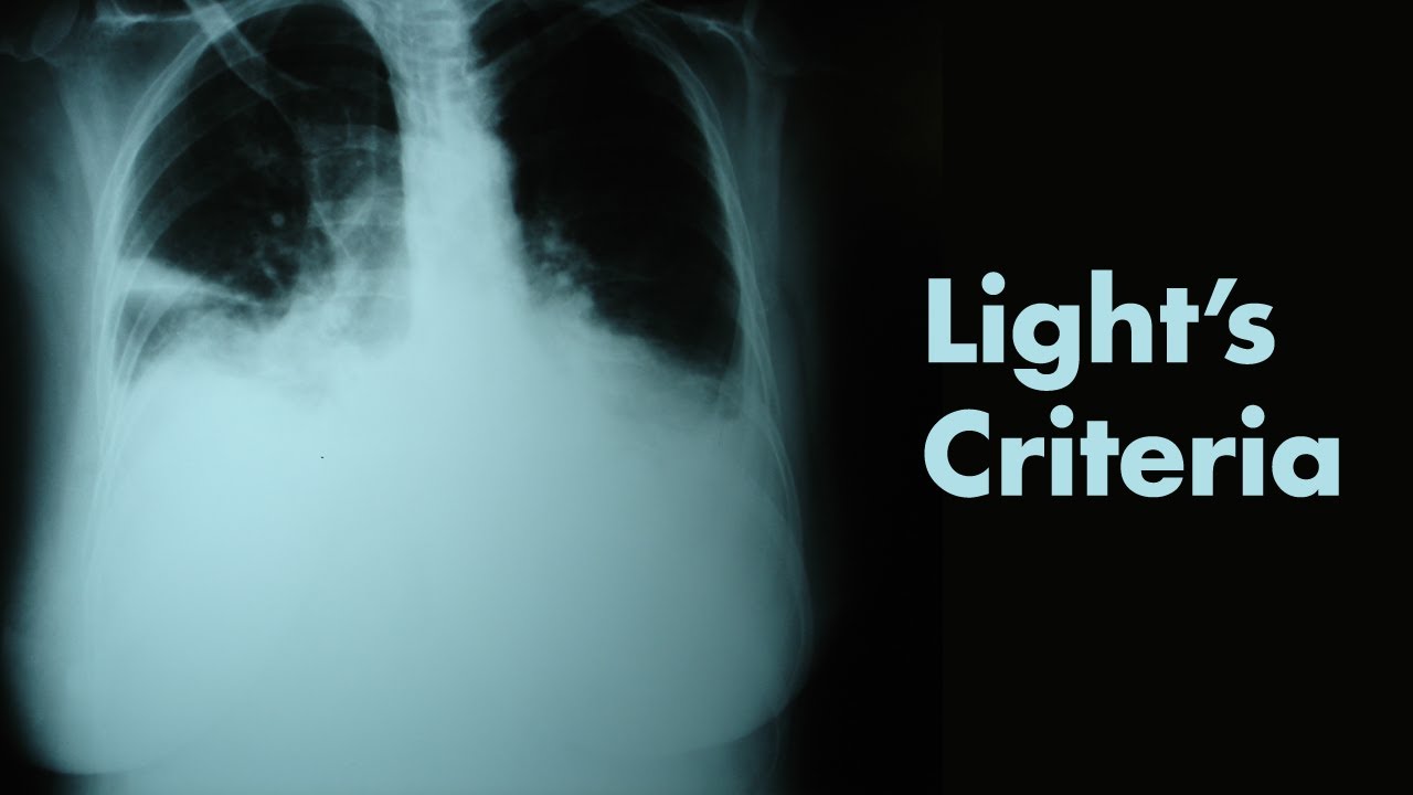 Light's Criteria & Pleural Effusions - MEDZCOOL