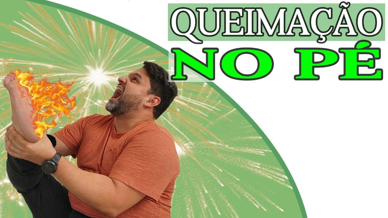 QUEIMAÇÃO NO PÉ - Como aliviar em 1 Minuto