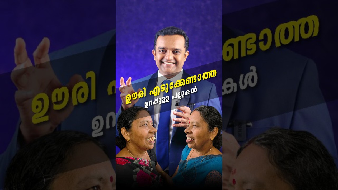 Permanent teeth without implants പല്ല് പറിക്കാതെ ഊരി എടുക്കേണ്ടാത്ത ഉറപ്പുള്ള പല്ലുകൾ