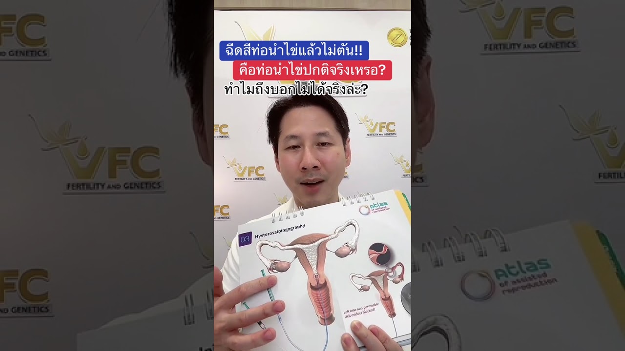 ตรวจท่อนำไข่ไม่ตัน  #อยากมีลูก แต่#มีลูกยาก รู้ได้อย่างไร ท่อปกติจริงรึเปล่า #อิ๊กซี่ #เด็กหลอดแก้ว