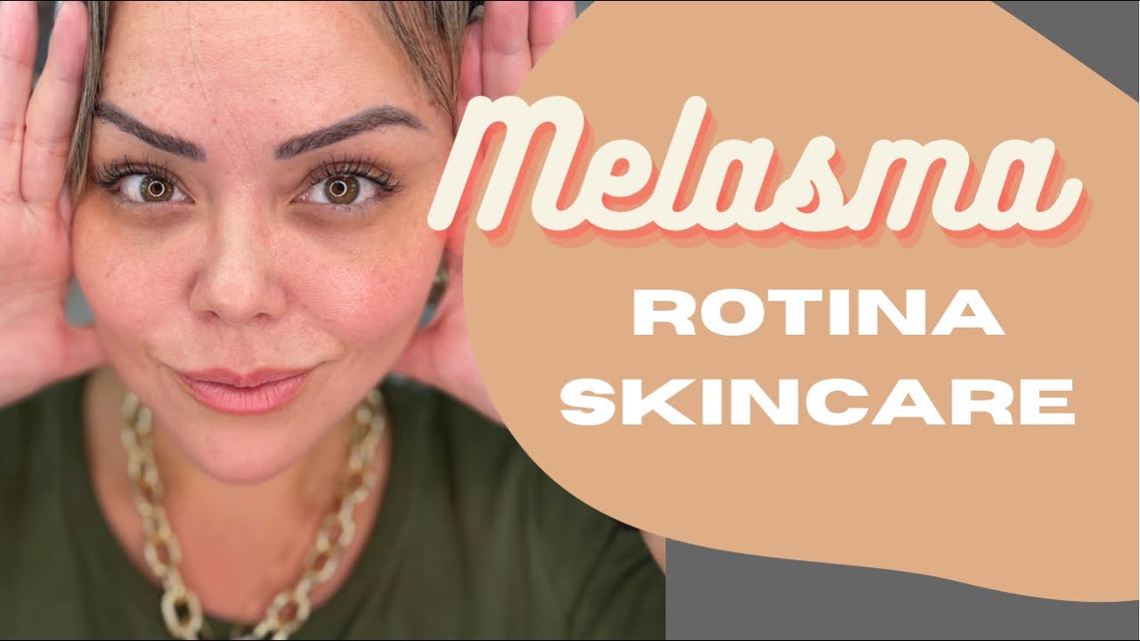Melasma - Produtos do Skin Care Diário