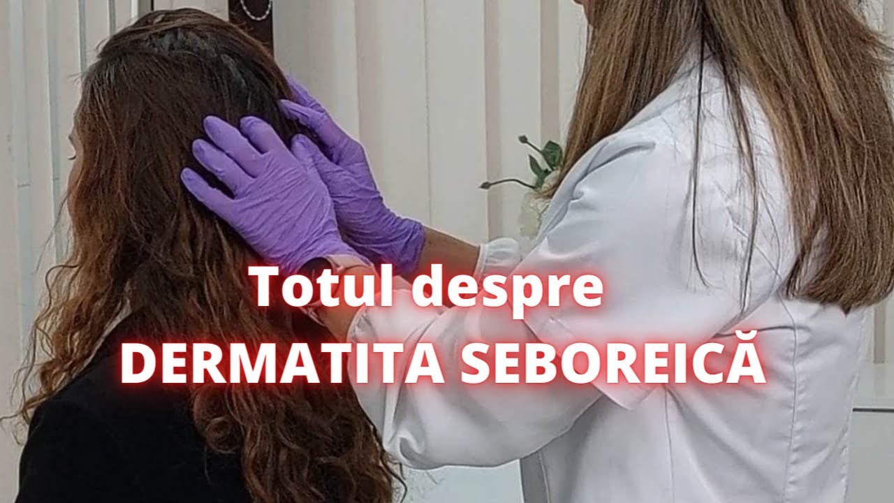Totul despre dermatita seboreica | DermaBeauty Clinique