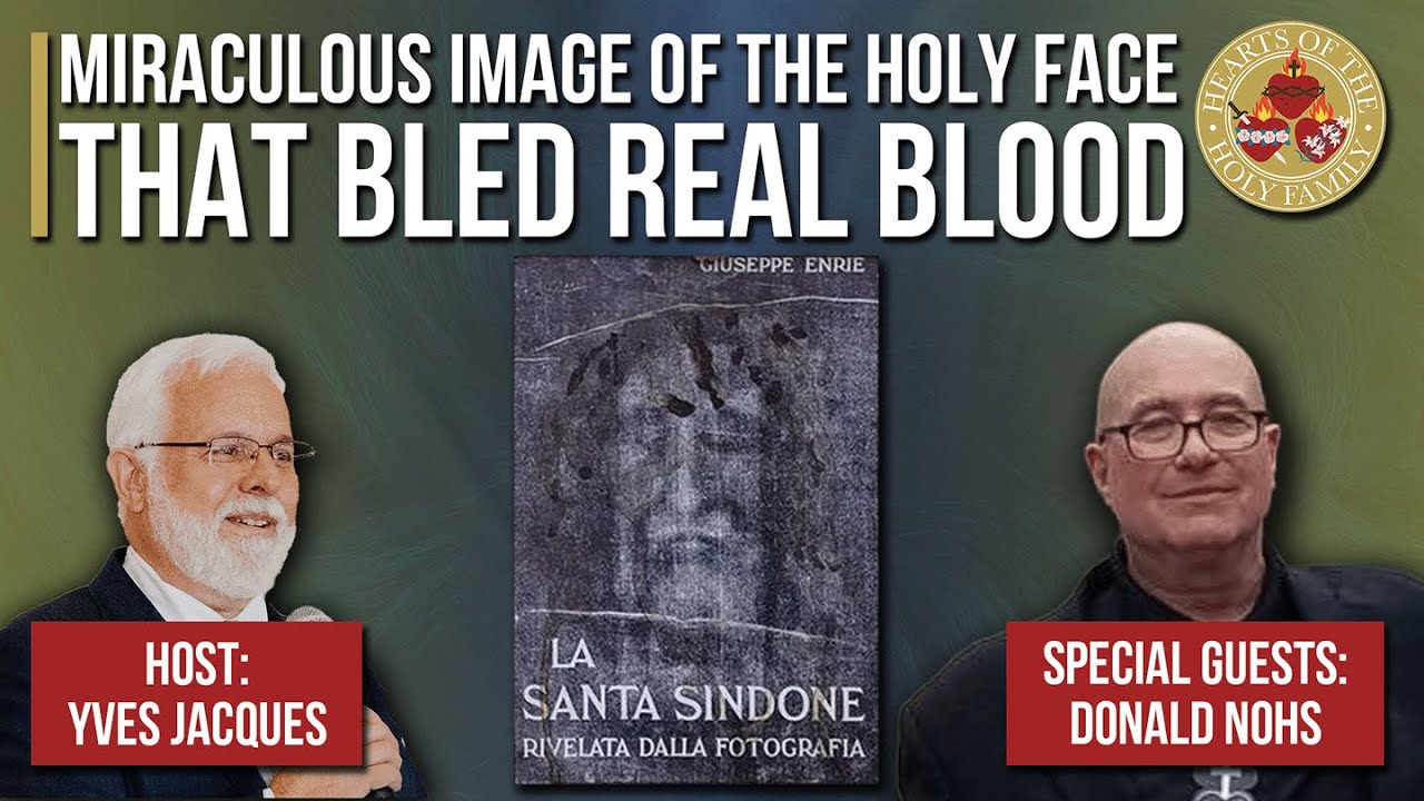 Miraculous Image of the Holy Face that Bled