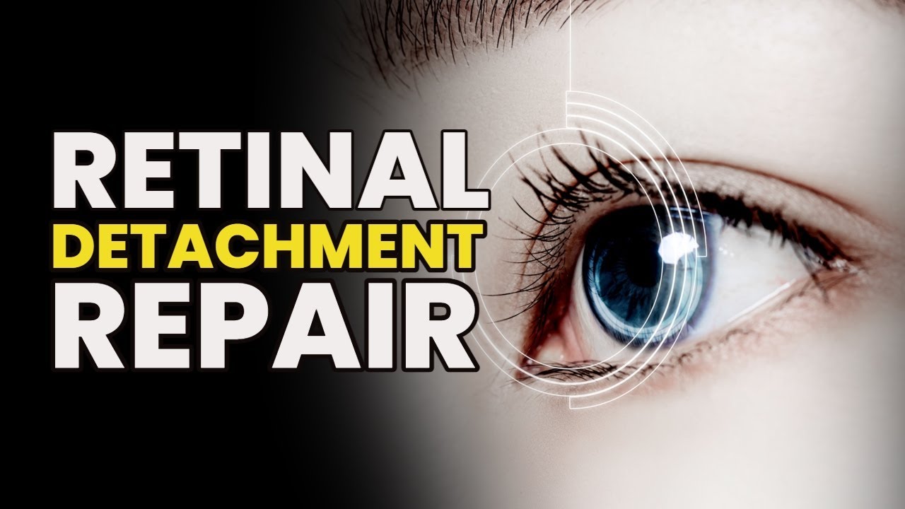 Get Rid Of Eye Floaters Fast | Remove The Vitreous | Retinal Detachment Repair | Eye Health Music
