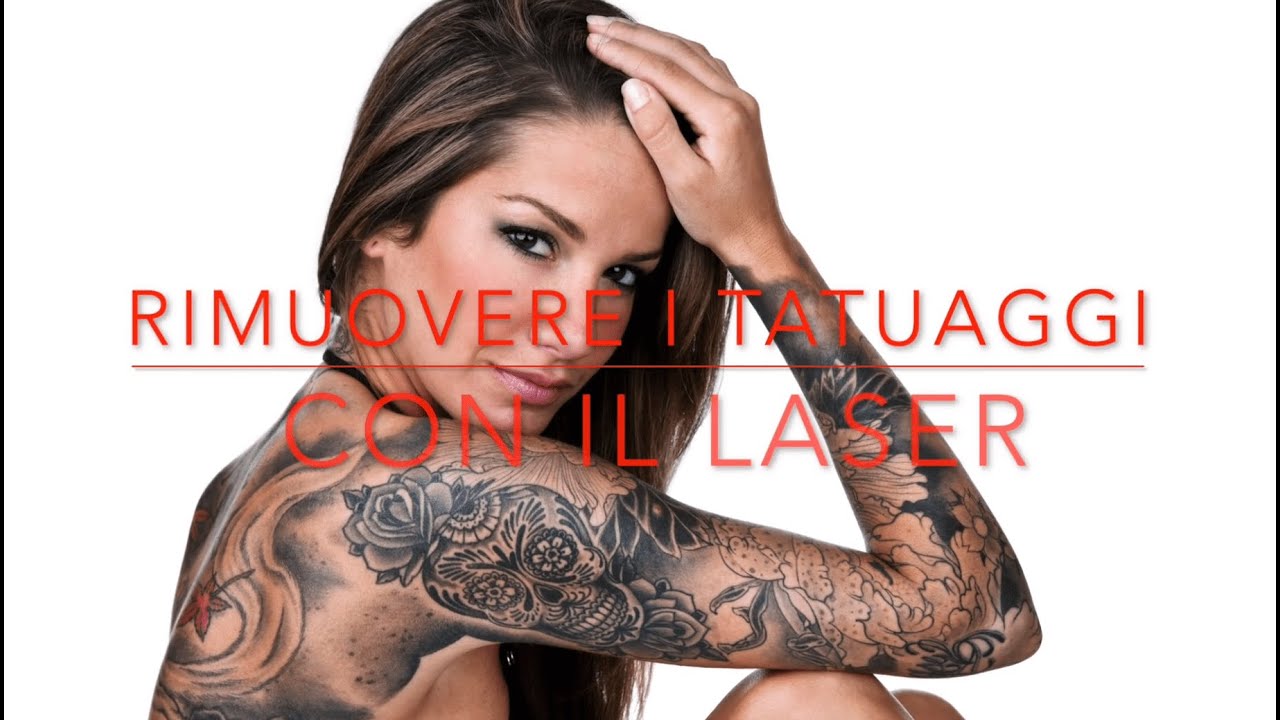 Rimozione tatuaggi con laser | Dr. Luigi Mazzi