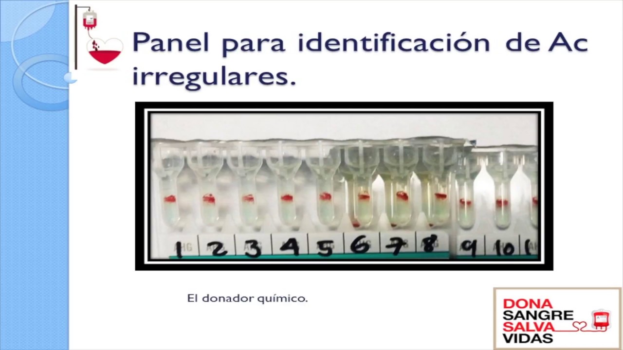 Cómo identificar el Fenotipo Bombay