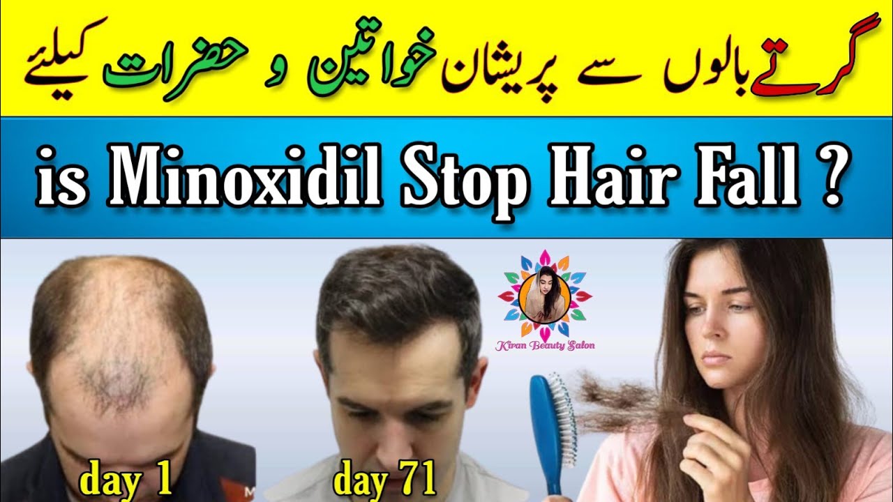 Best product for hair Growth || Stop Hair Fall instantly by using Minoxidil || uses and side effects