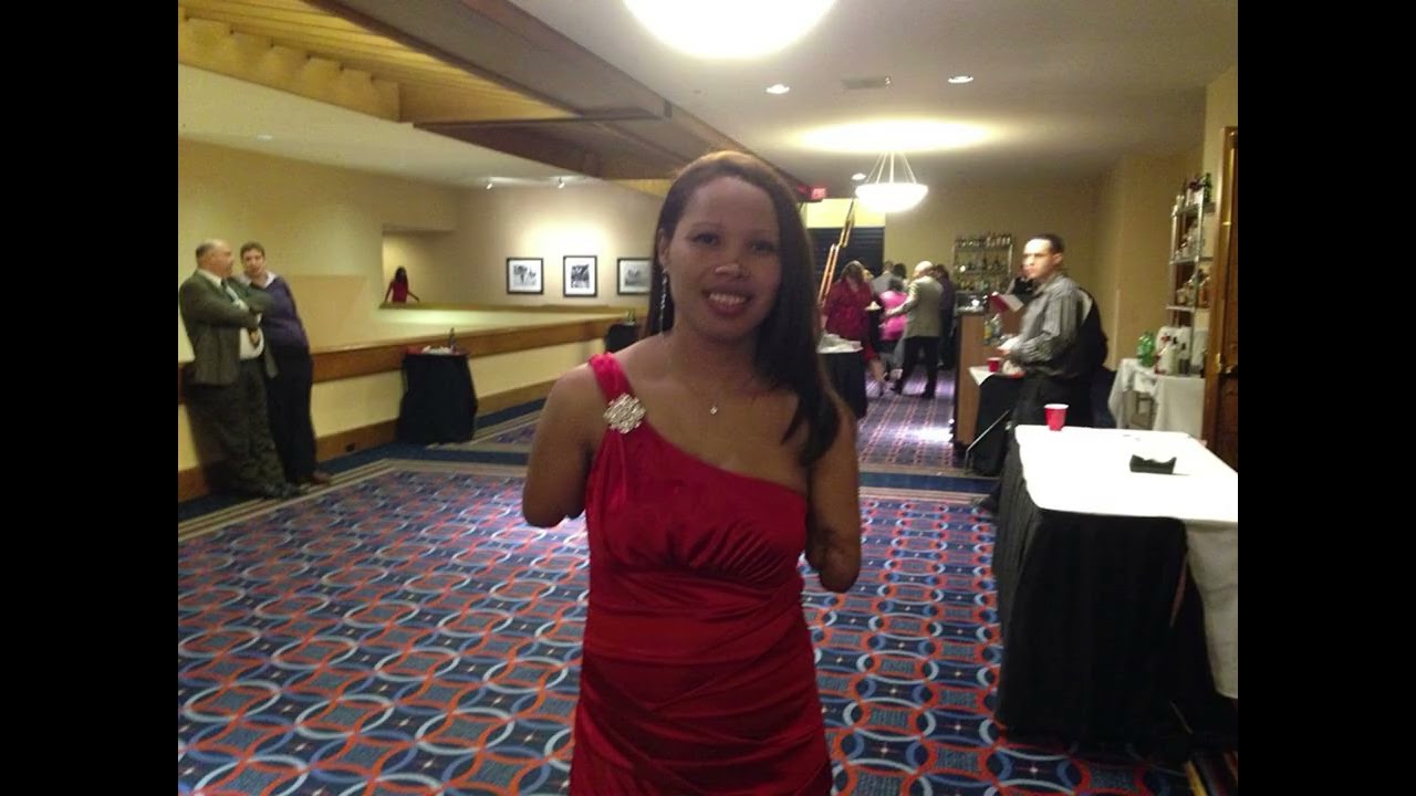 Amputee Pretty  Woman
