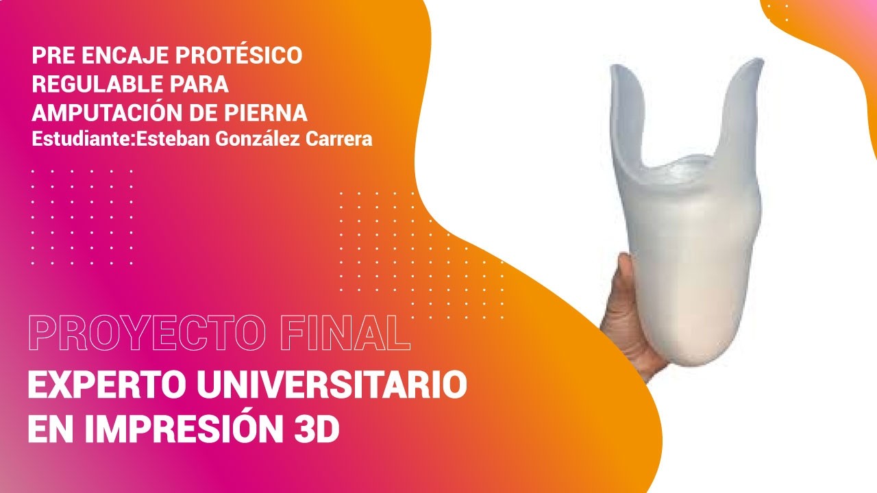 Proyecto Pre encaje para amputación de pierna | Proyecto final Experto Universitario en Impresión 3D