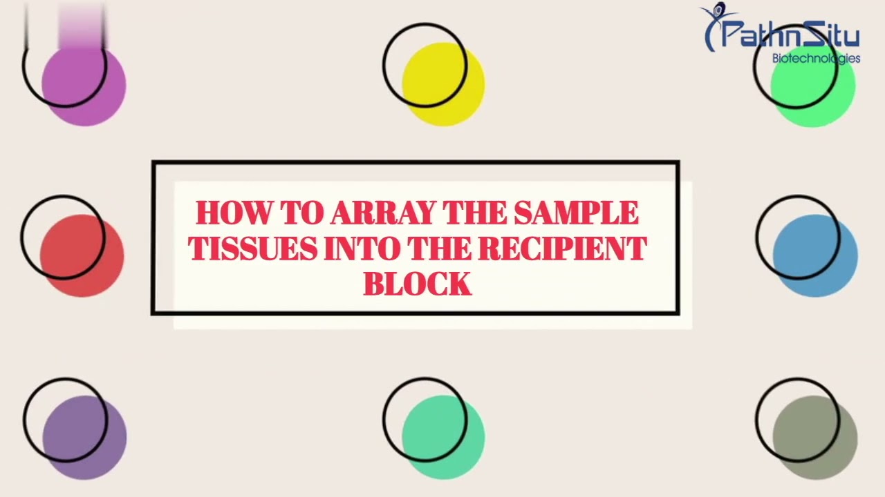 Tissue Microarray