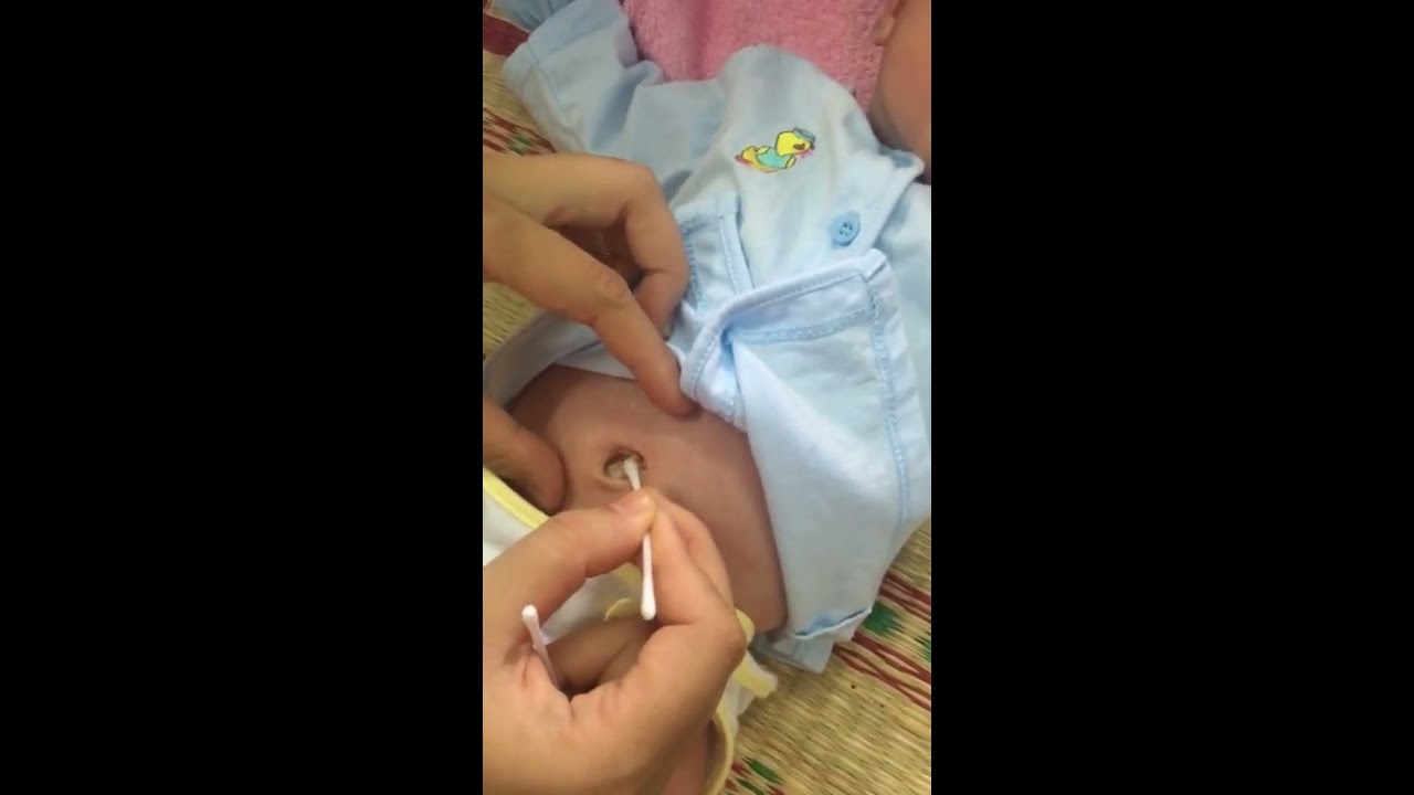 Cách chăm sóc rốn trẻ sơ sinh