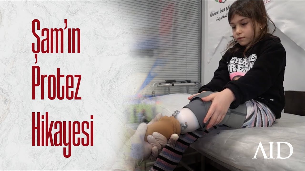 Şam'ın Protez Hikayesi