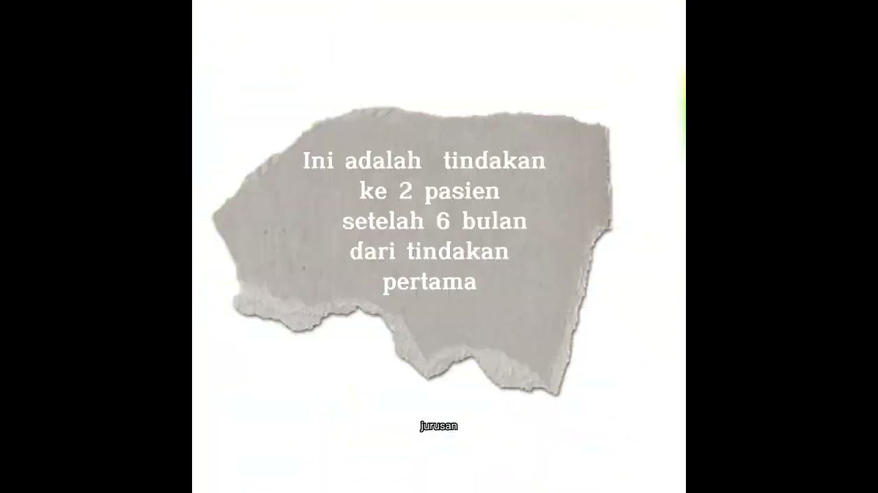 Tindakan Pasangan ring/stent pada pasien serangan jantung..🫀🫀 #cardiac ,#jantung #cathlab #vaskuler