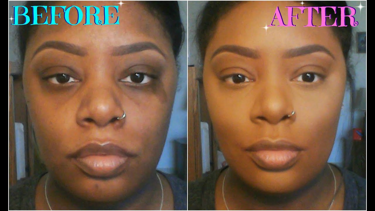 How To: Color Correct/Conceal Dark Circles, Acne Scars, & Birthmarks (For Dark Skin)