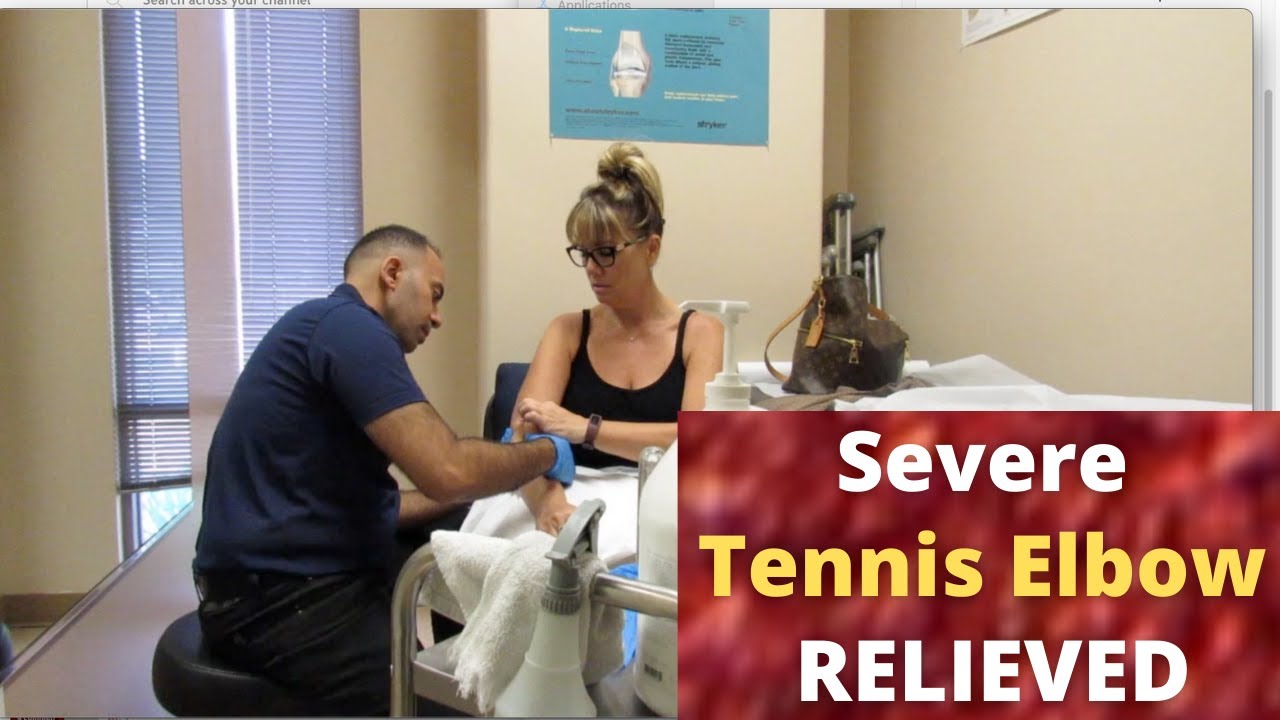 Extreme Tennis Elbow Pain Gone in Minutes with ASTR Devices!