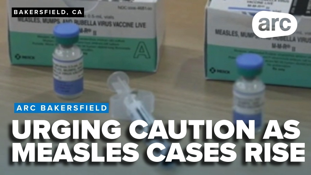 Health officials urge caution as measles cases rise