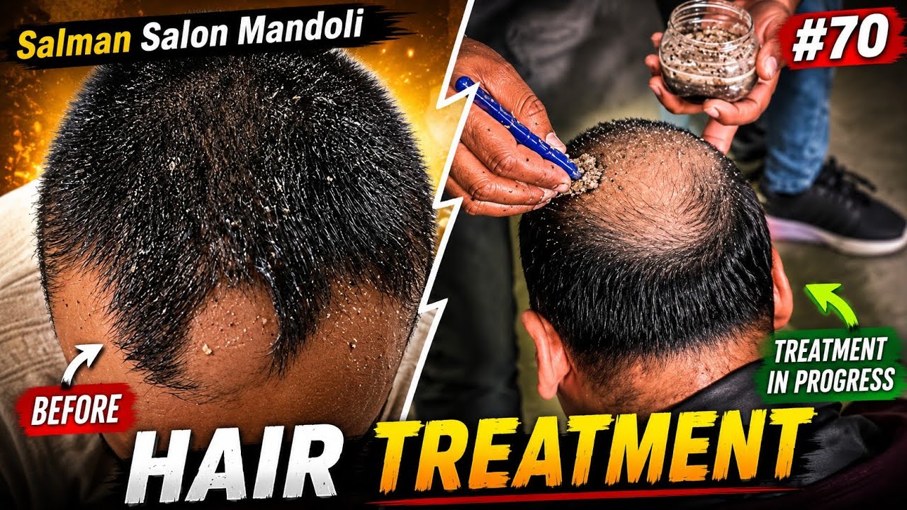 Salman Salon Mandoli Hair Treatment !! #hairtreatment