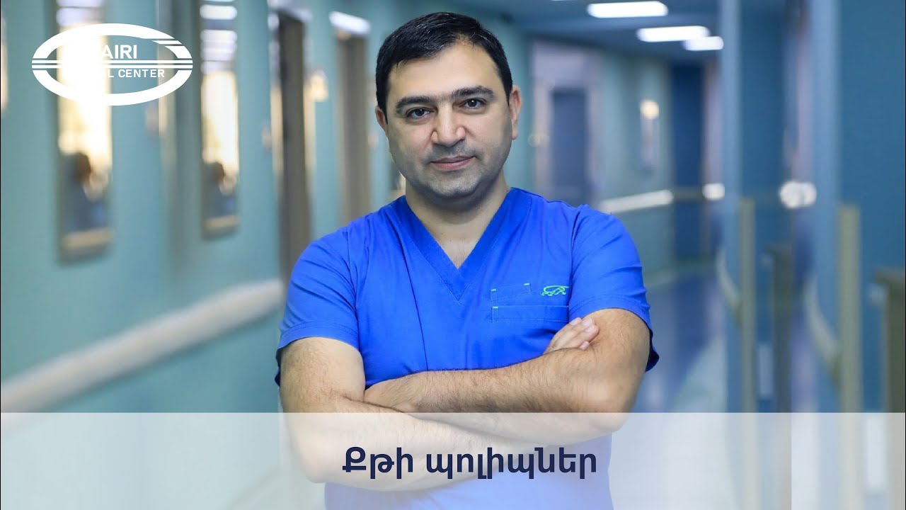 Քթի պոլիպներ