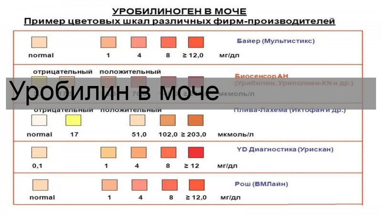 Уробилин в моче
